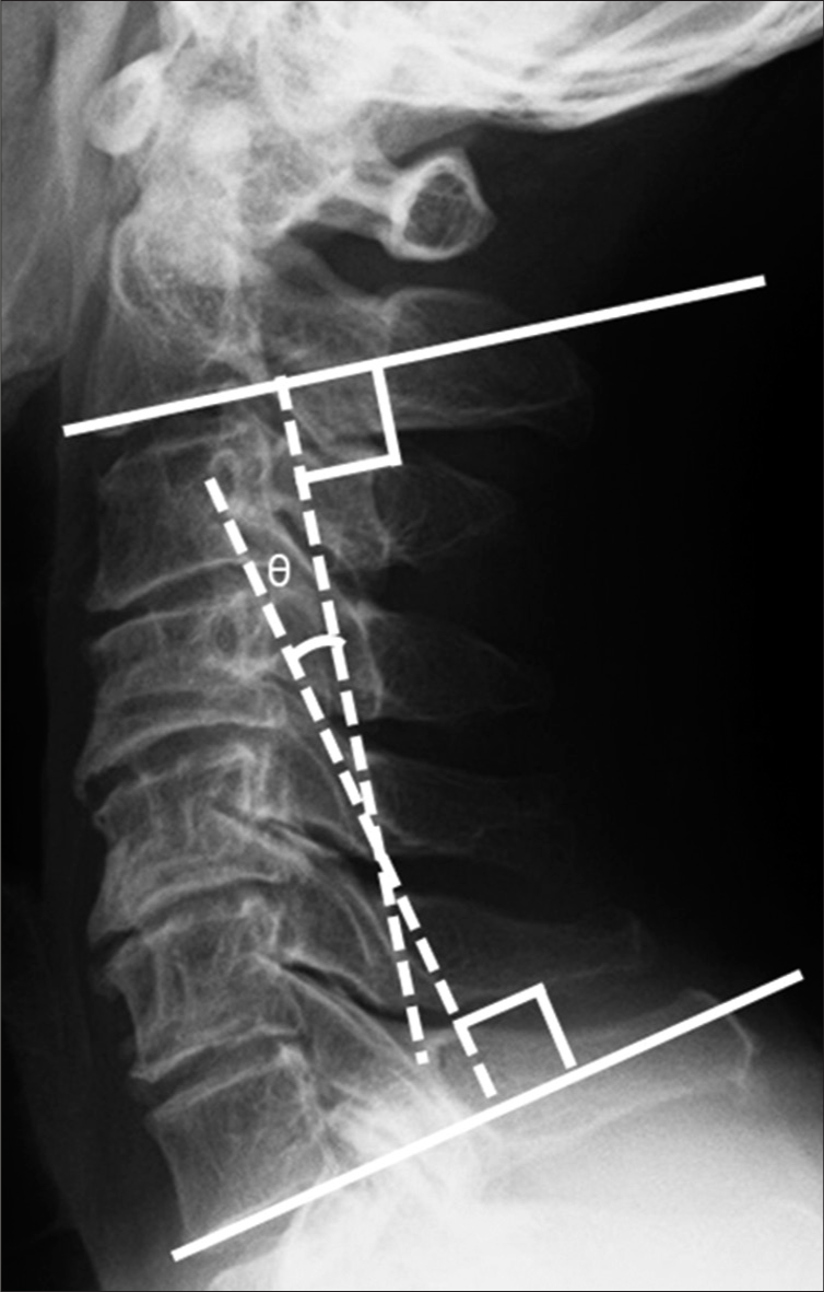 Surgical Neurology International