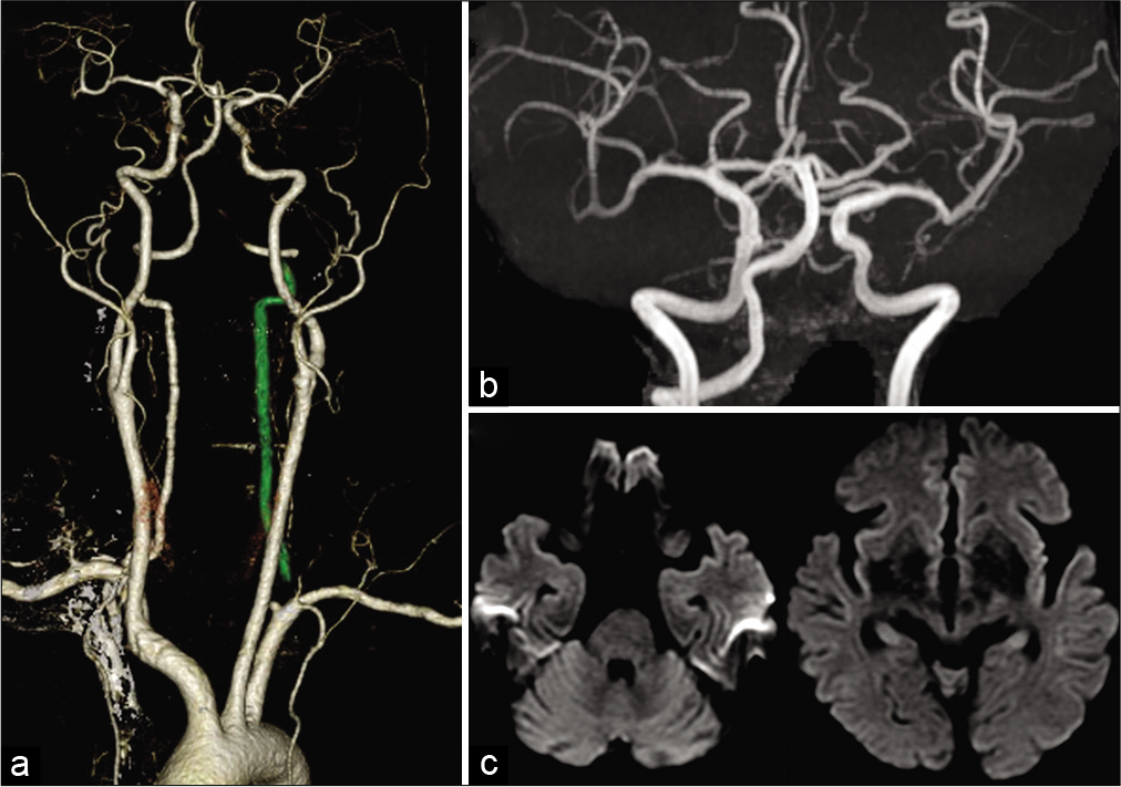 Surgical Neurology International