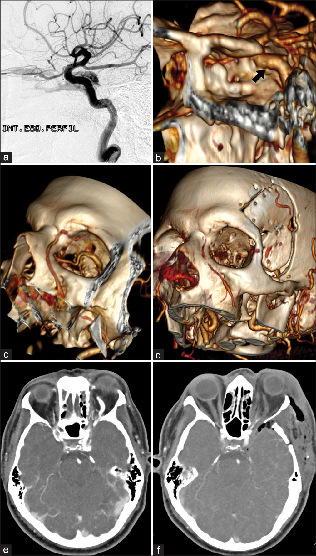 Leonardo Correa - Anatomy Studies